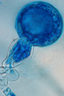 Oospore d'oomyc&egrave;te